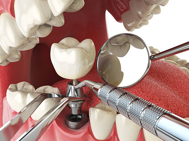 Best Cracked Tooth Emergency Dentist  in Carnegie, OK